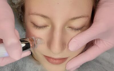 Oczyszczanie wodorowe